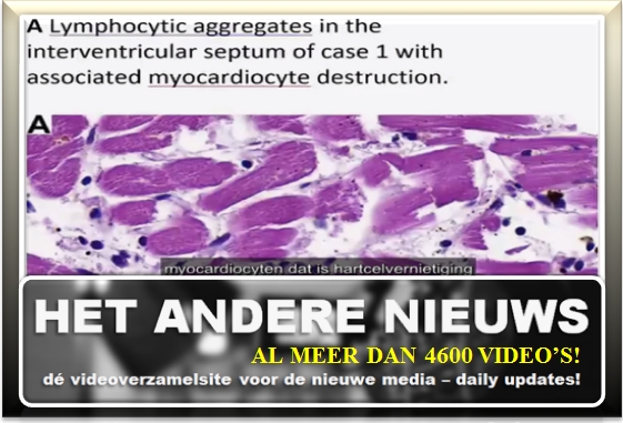 hetanderenieuws.nl